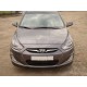 Ресницы накладки на фары Hyundai Solaris (2010-...)